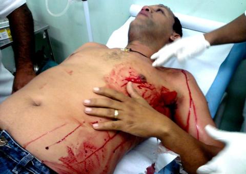  Oficial de Justiça  acusado de esfaquear  vereador